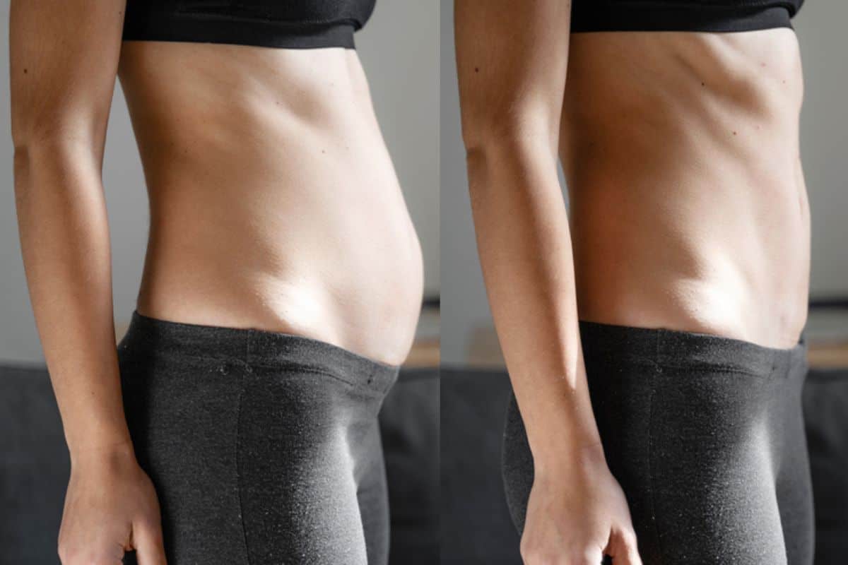 Post-Pregnancy: What Happens to Your Abdominal Muscles After Birth Greater London (Hammersmith and Fulham)