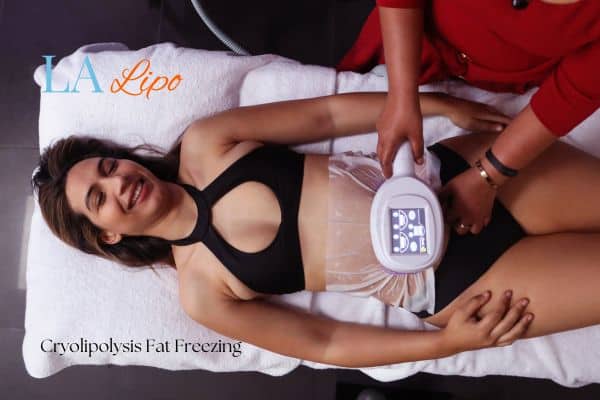 woman getting cryolipolysis Greater London (Hammersmith and Fulham)