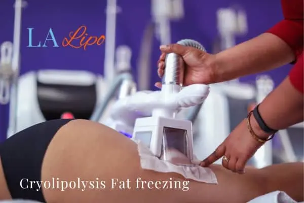 women getting fat freezing Greater London (Hammersmith and Fulham)