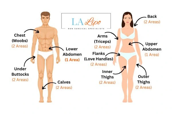 LA LIPO Cryolipolysis Areas Greater London (Hammersmith and Fulham)