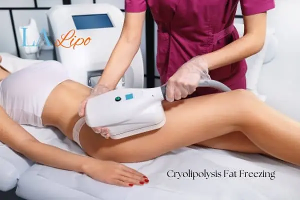 Woman receiving coolsculpting Greater London (Hammersmith and Fulham) treatment on her thighs