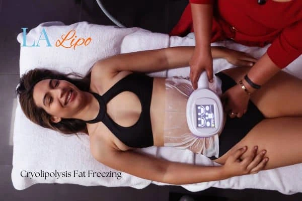 woman getting cryolipolysis Greater London (Hammersmith and Fulham)