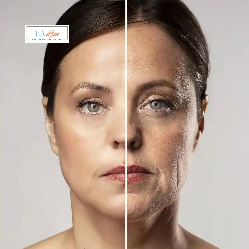 How Can You Tell If Non-Surgical Skin Tightening Is Right for You Greater London (Hammersmith and Fulham)?