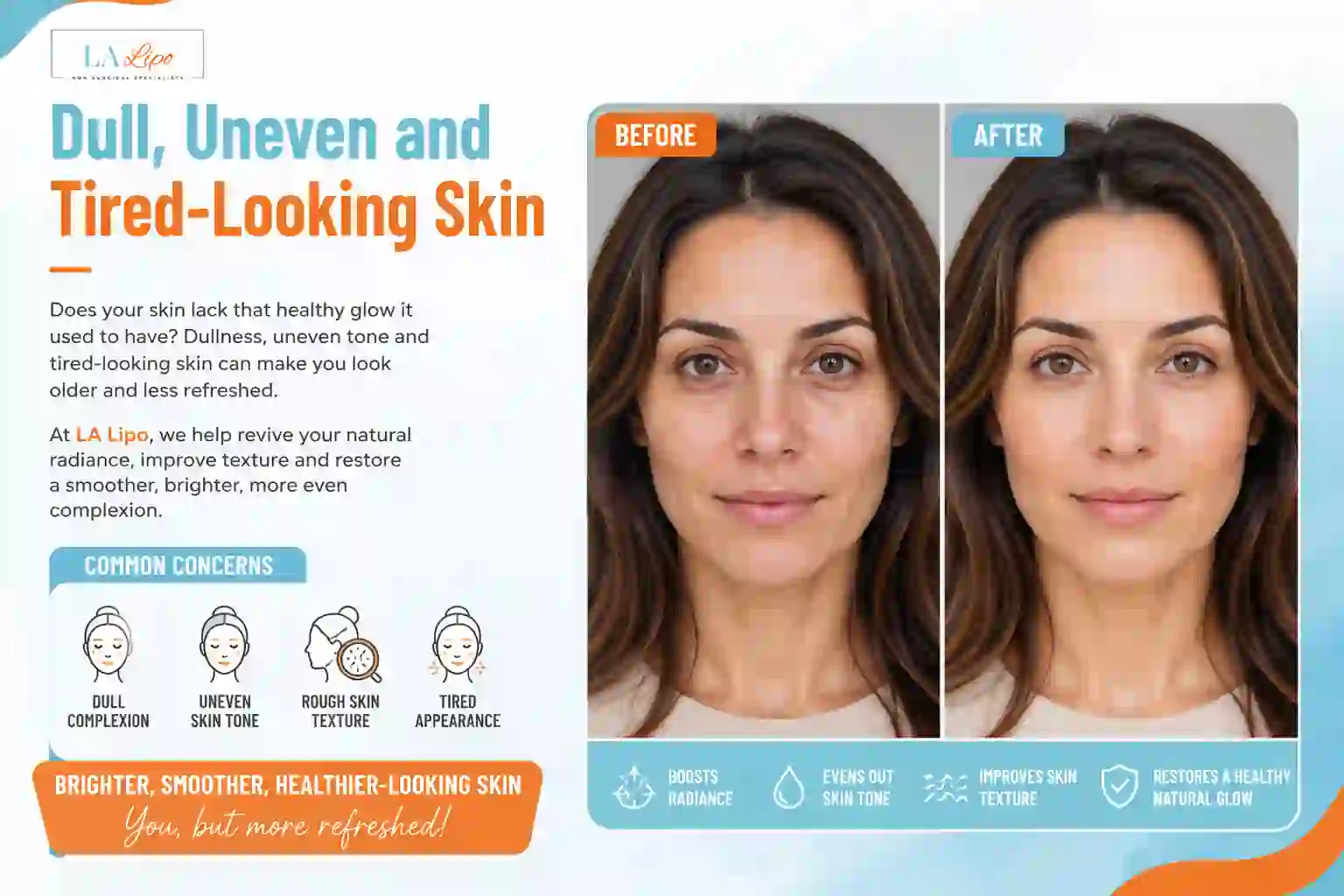 Sign #5: Dull, Uneven and Tired-Looking Skin Greater London (Hammersmith and Fulham)