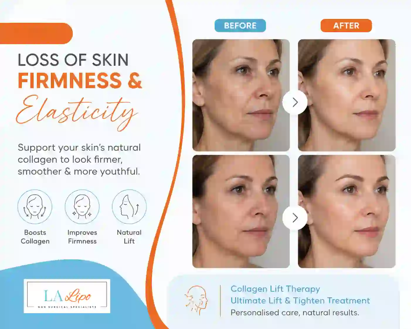 Sign #7: Loss of Skin Firmness and Elasticity Greater London (Hammersmith and Fulham)